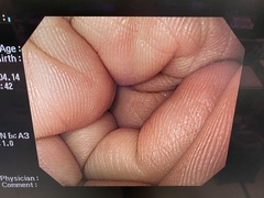 Video Gastroscope｜GIF-Q260｜Olympus Medical Systems photo7