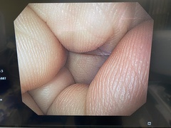 Video Gastroscope｜GIF-H260｜Olympus Medical Systems photo7