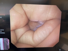 上部消化管汎用ビデオスコープ｜GIF-H290Z｜オリンパスメディカルシステムズ株式会社の写真7枚目