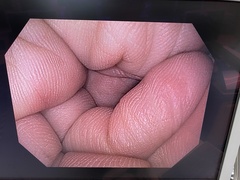 上部消化管汎用ビデオスコープ｜GIF-H190｜オリンパスメディカルシステムズ株式会社の写真7枚目