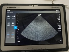 超音波診断装置｜Lumify｜フィリップスの写真7枚目