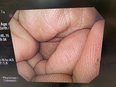 上部消化管汎用ビデオスコープ｜GIF-H260｜オリンパスメディカルシステムズ株式会社の写真7枚目