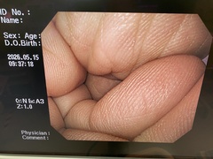 上部消化管汎用ビデオスコープ｜GIF-H260｜オリンパスメディカルシステムズ株式会社の写真7枚目