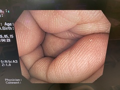 大腸ビデオスコープ｜CF-Q260AI｜オリンパスメディカルシステムズ株式会社の写真7枚目