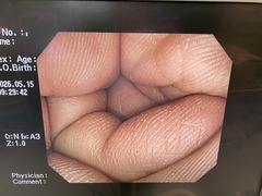 大腸ビデオスコープ｜CF-Q260AI｜オリンパスメディカルシステムズ株式会社の写真7枚目