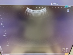 Ultrasound system(Color)｜SSA-590A  Nemio MX｜Canon Medical Systems photo5