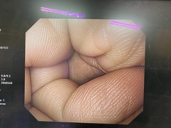 上部消化管汎用ビデオスコープ｜GIF-H260｜オリンパスメディカルシステムズ株式会社の写真7枚目