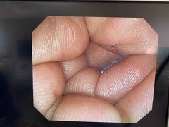 Video Colonoscope｜PCF-Q260AI｜Olympus Medical Systems photo7
