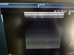 超音波診断装置｜ARIETTA 850｜日立製作所の写真7枚目