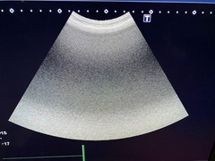 Ultrasound system(Color)｜Aplio 300｜Canon Medical Systems photo7
