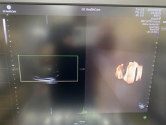 Ultrasound system｜Voluson Expert 22｜GE Healthcare photo7