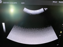 Ultrasound system(Color)｜LOGIQ S8 FS｜GE Healthcare photo4