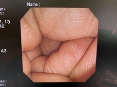 上部消化管経鼻ビデオスコープ｜GIF-N260｜オリンパスメディカルシステムズ株式会社の写真7枚目