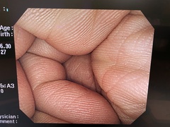大腸ビデオスコープ｜CF-H260DL｜オリンパスメディカルシステムズ株式会社の写真7枚目