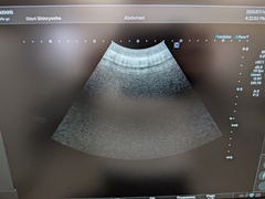 Ultrasound system(Color)｜Aplio go(CUS-AGG00)｜Canon Medical Systems photo7