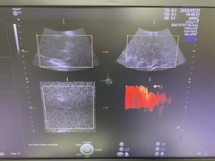 Ultrasound system(Color)｜Voluson E10｜GE Healthcare photo7