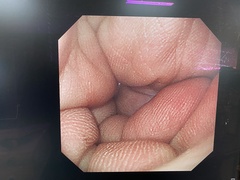 Video Gastroscope｜GIF-XQ240｜Olympus Medical Systems photo7