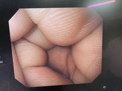 Video Gastroscope｜GIF-H260｜Olympus Medical Systems photo7