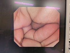 Video Colonoscope｜PCF-Q260AI｜Olympus Medical Systems photo7