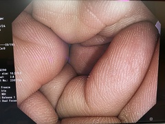 上部消化管汎用ビデオスコープ｜GIF-HQ290｜オリンパスメディカルシステムズ株式会社の写真7枚目