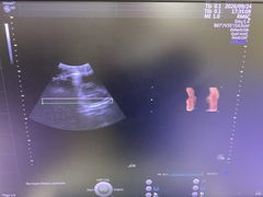 4D超音波診断装置（カラードプラ）｜Voluson E10｜GEヘルスケアの写真7枚目