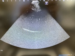 Ultrasound system｜Aplio 300 TUS−A300｜Canon Medical Systems photo7