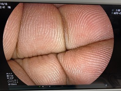 Video Duodenoscope｜ED-530XT8｜Olympus Medical Systems photo7