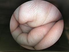 上部消化管用経鼻スコープ｜EG-3000N｜富士フイルムメディカルの写真8枚目