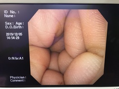 上部消化管汎用ビデオスコープ｜GIF-Q230｜オリンパスメディカルシステムズ株式会社の写真8枚目