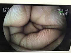 上部消化管用スコープ｜EG-250HR2｜富士フイルムメディカルの写真8枚目