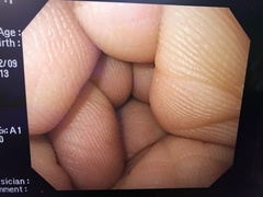上部消化管汎用ビデオスコープ｜GIF-Q240｜オリンパスメディカルシステムズ株式会社の写真8枚目