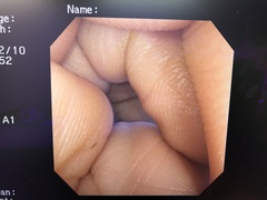 Video Gastroscope｜GIF-2T200｜Olympus Medical Systems photo8