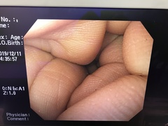 上部消化管汎用ビデオスコープ｜GIF-Q260｜オリンパスメディカルシステムズ株式会社の写真8枚目