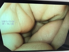 Video Gastroscope｜GIF-PV70｜Olympus Medical Systems photo8
