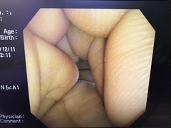 上部消化管汎用ビデオスコープ(径鼻対応)の写真8枚目
