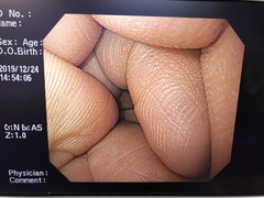 上部消化管汎用ビデオスコープ｜GIF-H260｜オリンパスメディカルシステムズ株式会社の写真8枚目