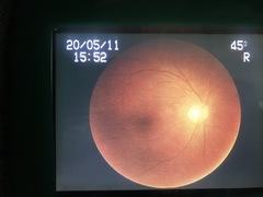 Non-Mydriatic Retinal Camera｜nonmyd α｜kowa photo8