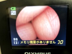 Airway mobile scope｜MAF TYPE GM｜Olympus Medical Systems photo8