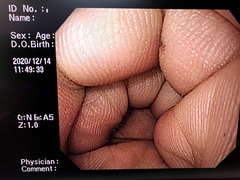 Video Gastroscope｜GIF-H260｜Olympus Medical Systems photo8