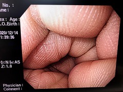 Video Gastroscope｜GIF-H260｜Olympus Medical Systems photo8