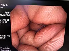 Video Colonoscope｜PCF-Q260AI｜Olympus Medical Systems photo7