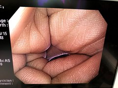Video Gastroscope｜GIF-Q260｜Olympus Medical Systems photo8