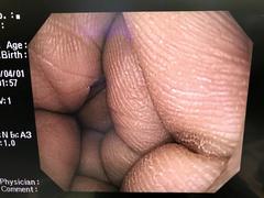 Video Gastroscope｜GIF-Q260｜Olympus Medical Systems photo8