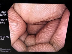 Video Gastroscope｜GIF-H260Z｜Olympus Medical Systems photo6