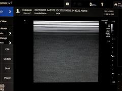 Ultrasound System(Color)｜Viamo SV7   CUS-VSV7｜Canon Medical Systems photo8