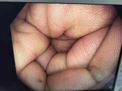 大腸ビデオスコープ｜CF-HQ290I｜オリンパスメディカルシステムズ株式会社の写真5枚目
