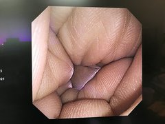 上部消化管汎用ビデオスコープ(径鼻対応)｜GIF-XP260N｜オリンパスメディカルシステムズ株式会社の写真8枚目