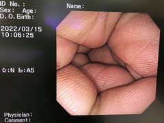 大腸ビデオスコープ｜CF-240I｜オリンパスメディカルシステムズ株式会社の写真8枚目