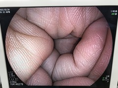 上部消化管用経口スコープ｜EG-6600R｜富士フイルムメディカルの写真8枚目