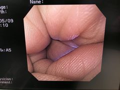 Video Gastroscope｜GIF-XQ200｜Olympus Medical Systems photo8